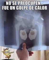 fue-solo-un-golpe-de-calor.jpg